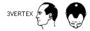 vertex.JPG