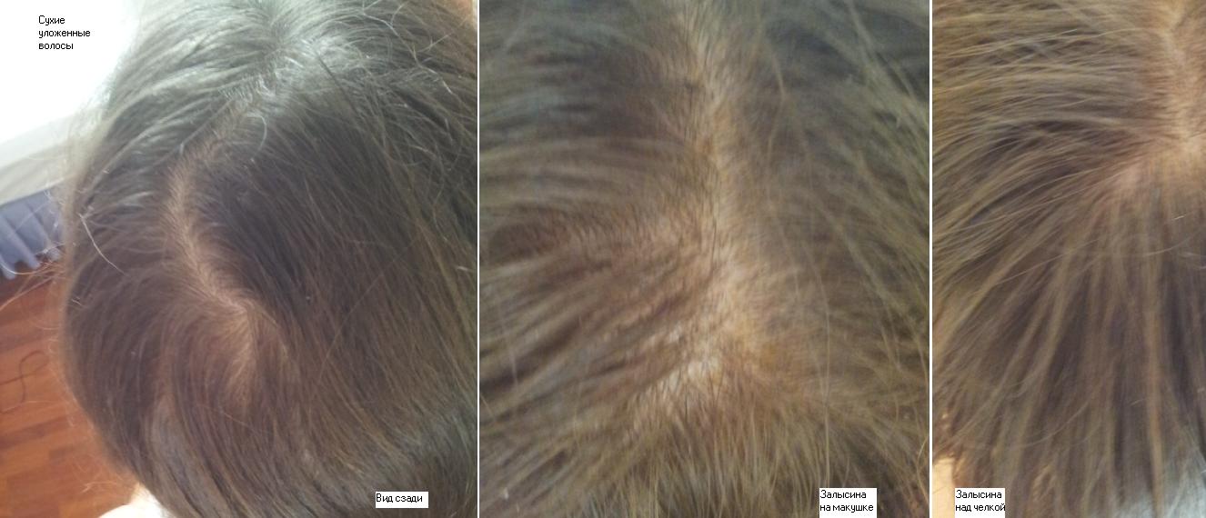 Hair_07.02.2015.JPG