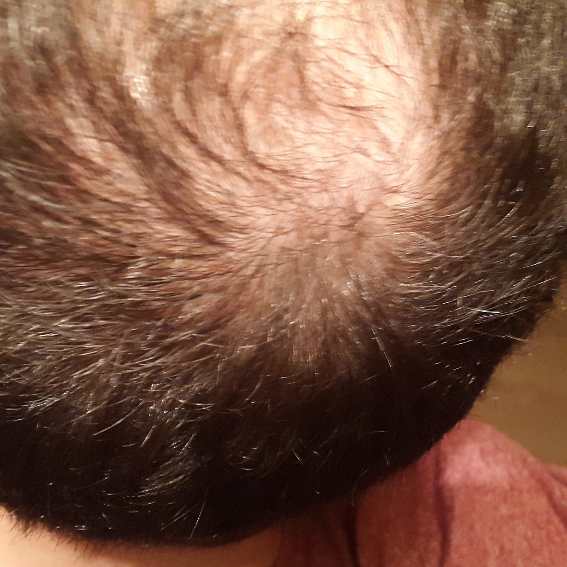 20150311_220126.jpg