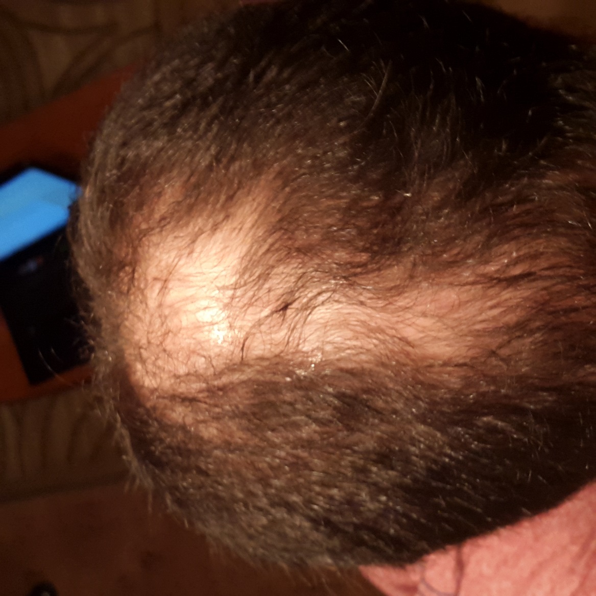 20150311_220343.jpg