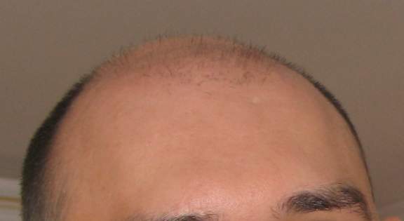 Лето 2006 (к концу 2008 даже пуха уже не было, но удачных фото того периода нет)