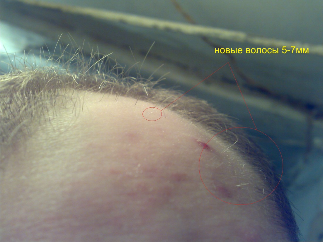 Вот молодые волосята)