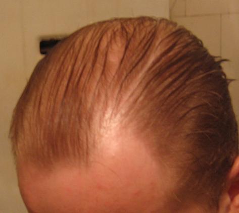 Head1.JPG