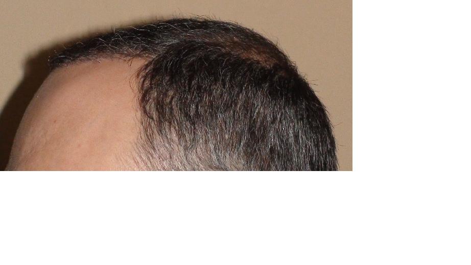 1.JPG