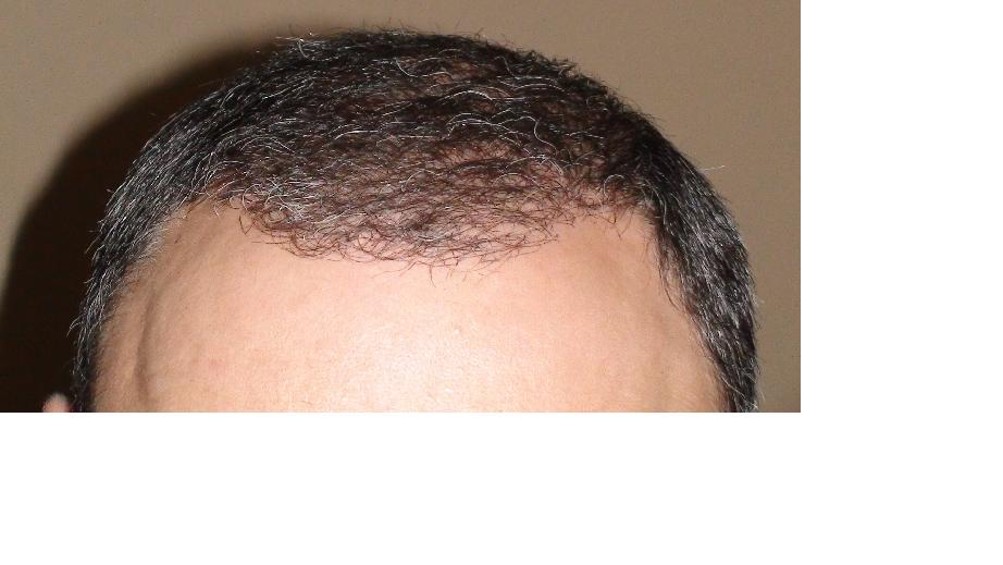 2.JPG